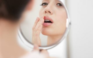 a woman with cold sores caused by HSV1 ,wondering what is the best treatment for cold sores and what causes cold sores