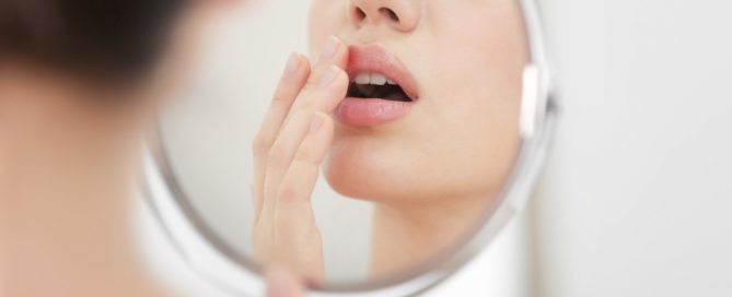 a woman with cold sores caused by HSV1 ,wondering what is the best treatment for cold sores and what causes cold sores