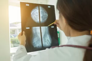 breast lump