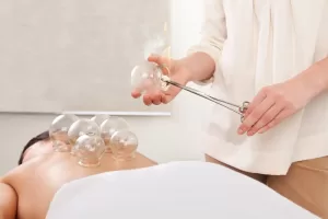 cupping