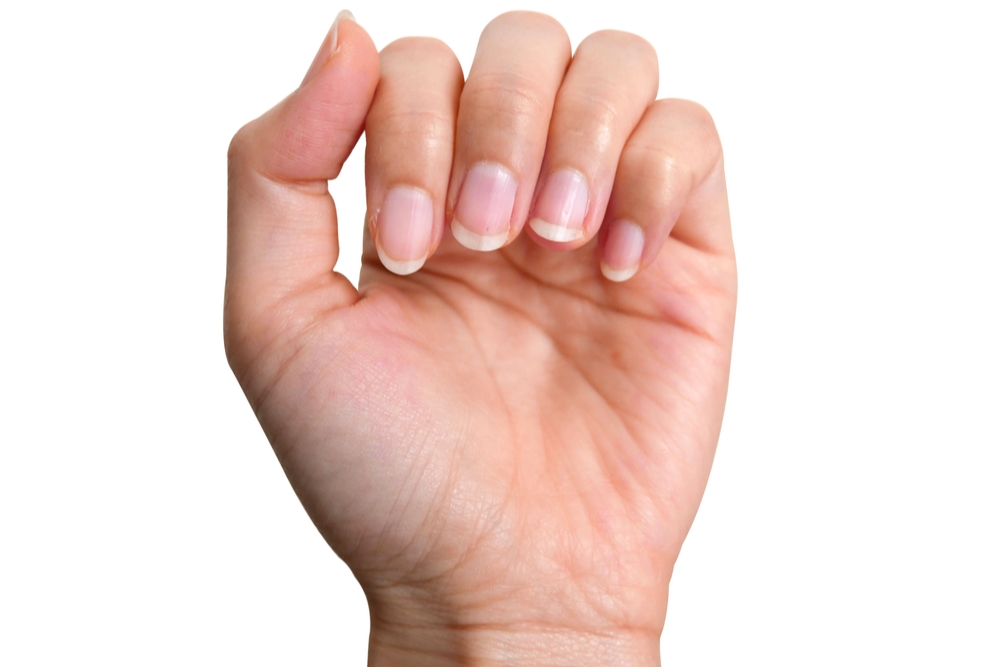 Onycholysis Nail: Causes & Prevention - RemoteDerm