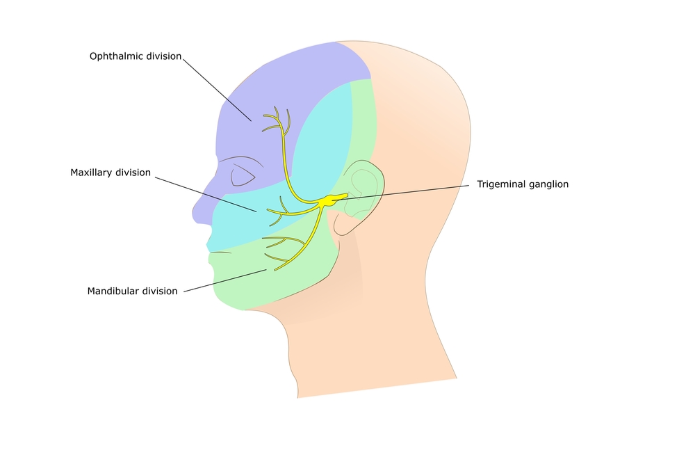 Trigeminal Neuralgia symptoms & treatment Qoctor your online doctor