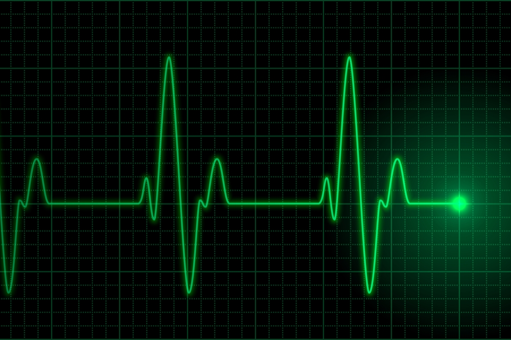 palpitations-what-are-they-and-are-they-serious-qoctor-your-online-doctor