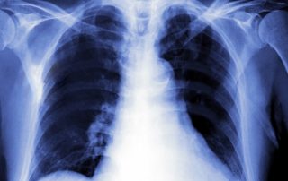 are xrays dangerous?