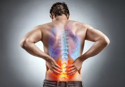 Sciatica is a shooting pain starting in the lower back/buttock