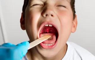 A child's mouth is wide open with tonsils enlarged, visible in the white or yellowish tinge