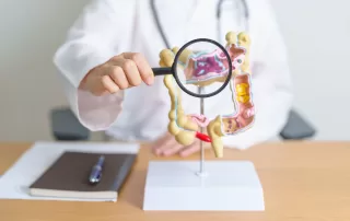 Doctor showing a human colon anatomy model to explain where ulcerative colitis occurs